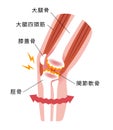 Mechanism and causes of knee joint pain / Japanese