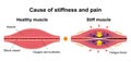 Process of muscle`s stiffness and pain / English