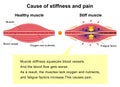 Process of muscle`s stiffness and pain / English