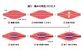 Process of muscle`s stiffness and pain / Japanese