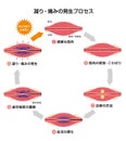 Process of muscle`s stiffness and pain / Japanese