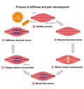 Process of muscle`s stiffness and pain / English