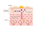 Generation mechanisim of athlete`s foot ringworm vector illustration