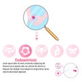 Medical infographic Endometriosis that could be causing women period pain.