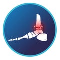 Fracture ankle icon. Vector flat design for radiology orthopedic research hospital for body joints