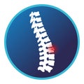 Fracture lumbar spine icon. Vector flat design for radiology orthopedic research hospital