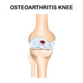 Molecular structure osteoarthritis pain background. Abstract traumatology and orthopedics