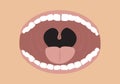 Opened Mouth concept with tonsils shown. Editable Clip art.