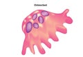 Osteoclast Royalty Free Stock Photo