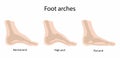illustration of biology and medical, Foot arches, metatarsal bones Royalty Free Stock Photo