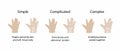 illustration of biology and medical, Types of hand syndactyly Royalty Free Stock Photo