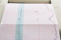 Printing of cardiogram report coming out from Electrocardiograph in labour ward Royalty Free Stock Photo