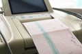 Printing of cardiogram report coming out from Electrocardiograph in labour ward Royalty Free Stock Photo