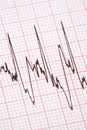 Printout from cardiograph Royalty Free Stock Photo