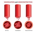 PrintVasodilation and vasoconstriction, Blood vessels comparison Vector Royalty Free Stock Photo