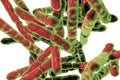 Probiotic Bacteria Bifidobacterium