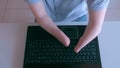 Disabled man with amputated stump hands is typing on laptop, closeup top view.