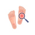 Problem skin of feet icon