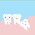Problems caused by impacted wisdom teeth include. Sleepy tooth of impacted tooth. dystopic teeth. funny cartoon illustration of th Royalty Free Stock Photo