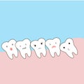 Problems caused by impacted wisdom teeth include. Sleepy tooth of impacted tooth. dystopic teeth. funny cartoon illustration of th Royalty Free Stock Photo