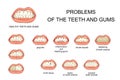 Problems of the teeth and gums Royalty Free Stock Photo