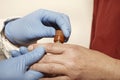 Technician collecting samples for SEM gunshot powder residue from suspected person Royalty Free Stock Photo