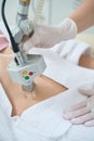 Procedure for laser removal of neoplasms on the abdomen in a cosmetology clinic Royalty Free Stock Photo