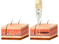 Procedure of permanent makeup. Cross section of layers of a human skin of Process of tattooing. Pigment under skin of