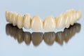 Procelain teeth on metallic basis Royalty Free Stock Photo