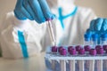 Process of coronavirus PCR antigen testing examination by nurse medic in laboratory lab, COVID-19 swab collection kit, test tube