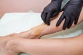 The process of epilation of the legs or parts of the female body using the sugaring method