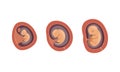 Process of Fetal Development or Embryological Stage Vector Set