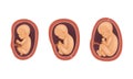 Process of Fetal Development or Embryological Stage Vector Set