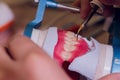 The process of making a dental prosthesis in a dental laboratory. Royalty Free Stock Photo