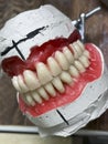 Removable denture in the laboratory on the table close-up. Royalty Free Stock Photo