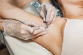 The process of permanent removal of unwanted hair in the armpit area using an electroepilation device and tweezers