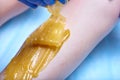 A process of sugaring depilation Royalty Free Stock Photo