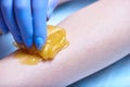 A process of sugaring depilation Royalty Free Stock Photo