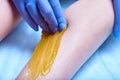 A process of sugaring depilation Royalty Free Stock Photo