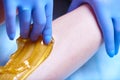 A process of sugaring depilation Royalty Free Stock Photo