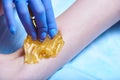 A process of sugaring depilation Royalty Free Stock Photo