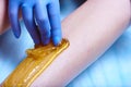 A process of sugaring depilation Royalty Free Stock Photo