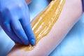 A process of sugaring depilation Royalty Free Stock Photo