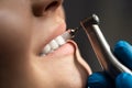 Process of using dental brush as a stage of professional dental cleaning procedure in clinic close up , healthcare concept