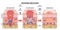 Process of wound healing and anatomical body injury repair outline diagram