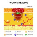 Process of wound healing