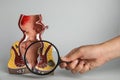 Proctologist holding magnifying glass near model of rectum with hemorrhoids on light background, closeup