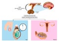 Production gonadotropins. FSH and LH are synthesized in the pituitary gland in response to gonadotropin-releasing Royalty Free Stock Photo