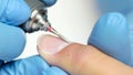 Professional of manicure cures the fingers of the client by apparatus. Close up