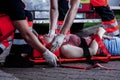 Medical rescuer bending over a car accident victim lying on a stretcher